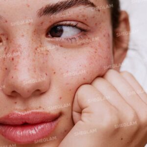تینت کک و مک قهوه ای صورت شیگلم رنگ Tan
