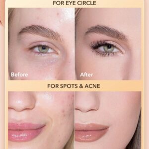 کانسیلر کرمی کاسه ای شیگلم مدل Rapid Retouch رنگ Pink Pearl